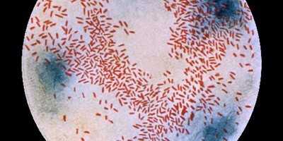 Дослідження антибіотикорезистентності SOAR в Україні та Словаччині